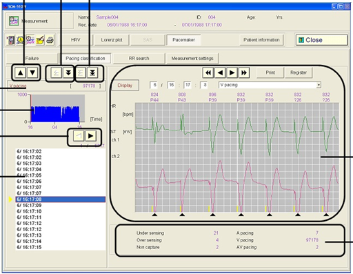 SCM-510W-Fukuda Denshi-ECG Holter softwave6(1).jpg